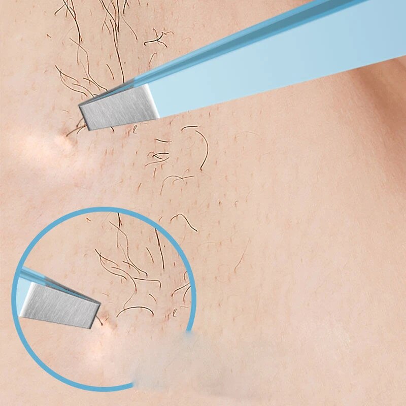EyeblogugTweezer-Pince à épile - Beauty Makeup Remover avis et prix
